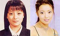 金喜善